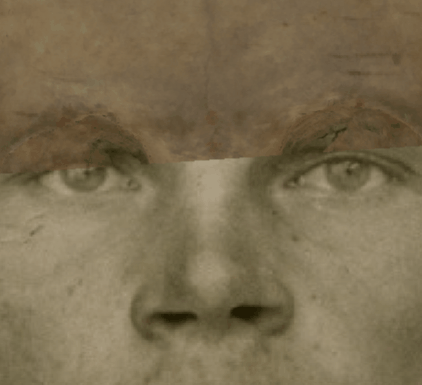 Example of a negative match in which the outline of the nose is evaluated with Skeleton·ID by means of the transparency and wipe tools, showing that the outline of the nasal bone does not maintain a symmetrical flow on both sides with the outline of the nose in the photograph in a consistent way. The nasal bone is larger and does not fit with the nose in the photograph. The wipe tool has been used to show a gradient from top to bottom and from left to right of the nasal bone over the nose