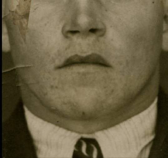 Example of a positive match in which the oblique line of the mandible is evaluated with Skeleton·ID by means of the transparency and wipe tools, showing that the oblique line of the mandible (left and right) on the face follows the oblique line of the mandible on the skull in a consistent way. The wipe tool has been used to show a gradient from right to left (anatomical) of the mandible on the skull over the face