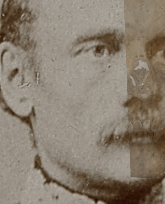 Example of a negative match in which the gonial outline is evaluated with the transparency and wipe tools, showing that the gonial outline does not follow the outline of the jaw in a consistent way. The wipe tool has been used to show a gradient from the chin to the jaw angle
