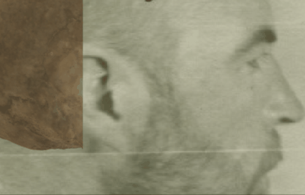 Example of a negative match in which the frontal process of the zygomatic arch and the zygomatic arch are evaluated with the transparency and wipe tools, showing that the frontal process is not aligned with the process in the face and the outline of the zygomatic arch can’t be fitted between the skull and the face (cause the zygomatic arch is larger than de facial width). The wipe tool has been used to show a gradient from the mastoid process to the frontal process of the zygomatic bone