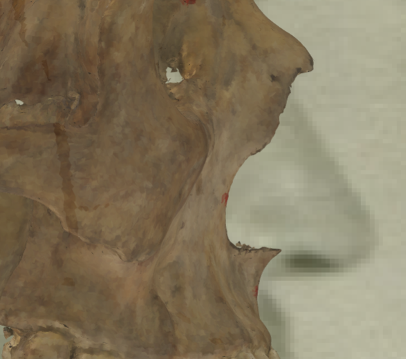 Ejemplo de un solapamiento negativo en vista lateral en la que se evalúa la posición de la espina nasal anterior con Skeleton·ID mediante la herramienta de transparencia, mostrando que la espina nasal se encuentra ubicada sobre la aleta nasal