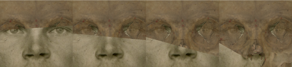 Example of a negative match in which the piriform aperture width and height is visually evaluated with Skeleton·ID by means of the transparency and wipe tools, showing that the piriform aperture width and height does not lie within the borders of the nose. The transparency tool has been used in combination with the wipe tool to show a gradient showing the position of the piriform aperture in relation to the nose in the face