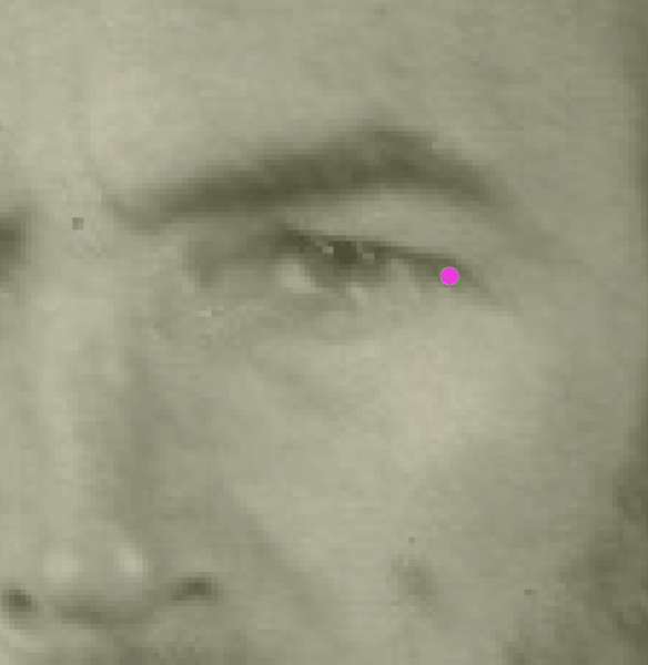 Example of a negative match in which the exocanthion is visually evaluated with Skeleton·ID by means of the transparency tool, showing that the left exocanthion in the face is not aligned with the Whitnall´s tubercle on the horizontal plane. In this case the exocanthion falls inside the orbit. The transparency tool has been used to show a gradient of opacity of the orbit