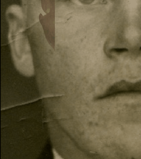 Example of a negative match in which the position of the gonial flare is visually evaluated with Skeleton·ID by means of the transparency and wipe tools, showing that the gonial flare in the skull and the postero-lateral jaw prominence in the face are inconsistent. The transparency tool has been used in combination with the wipe tool to show a gradient of the right jaw. In this case the gonial flare in the skull is not located at the same position of the postero-lateral prominence of the jaw in the face